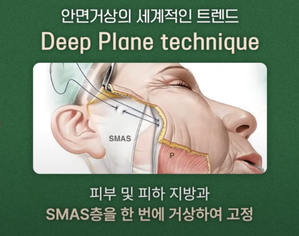 72c0a45c4a65f556686144aff2c25db0_1786957225_825.png